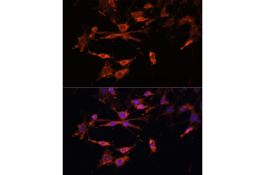 Immunofluorescence - Anti-MHC Class II beta Antibody (A306106) - Antibodies.com