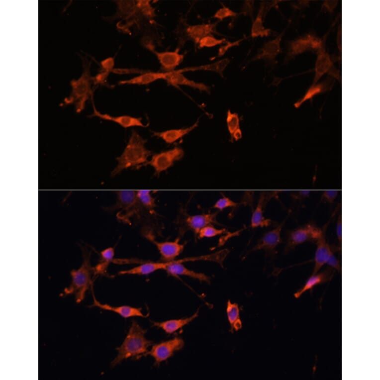 Immunofluorescence - Anti-MHC Class II beta Antibody (A306106) - Antibodies.com