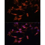 Immunofluorescence - Anti-MHC Class II beta Antibody (A306106) - Antibodies.com