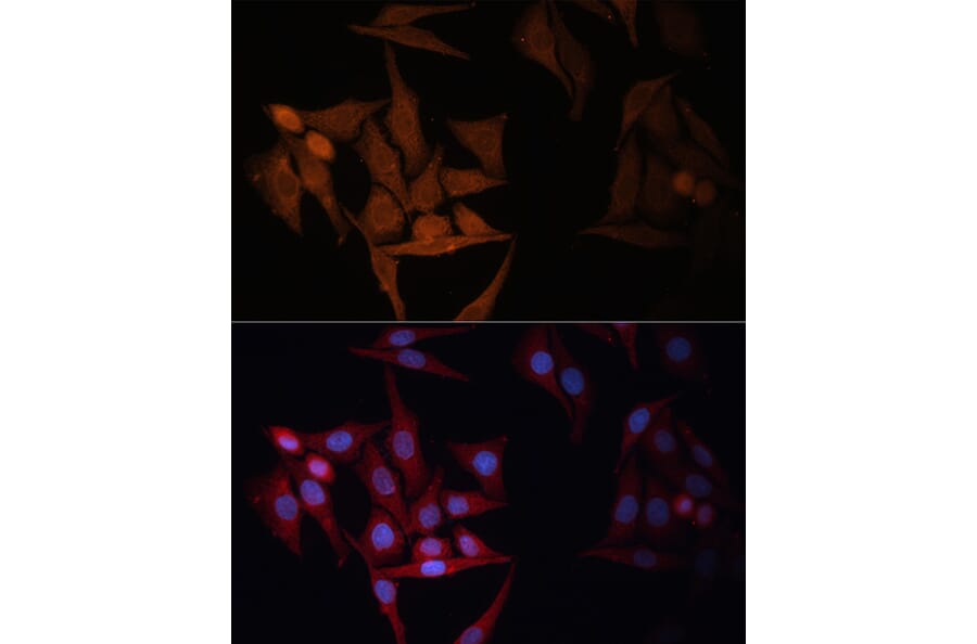 Immunofluorescence - Anti-MHC Class II beta Antibody (A306106) - Antibodies.com