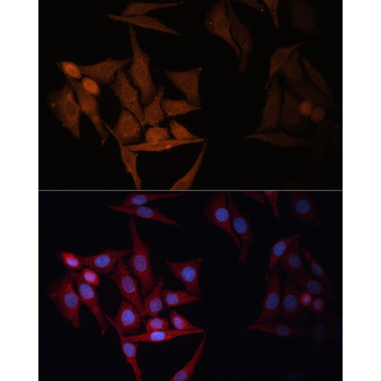 Immunofluorescence - Anti-MHC Class II beta Antibody (A306106) - Antibodies.com