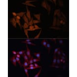Immunofluorescence - Anti-MHC Class II beta Antibody (A306106) - Antibodies.com