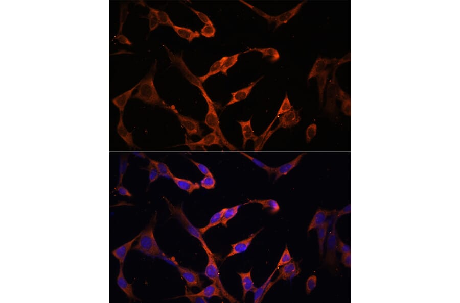 Immunofluorescence - Anti-MHC Class II beta Antibody (A306106) - Antibodies.com