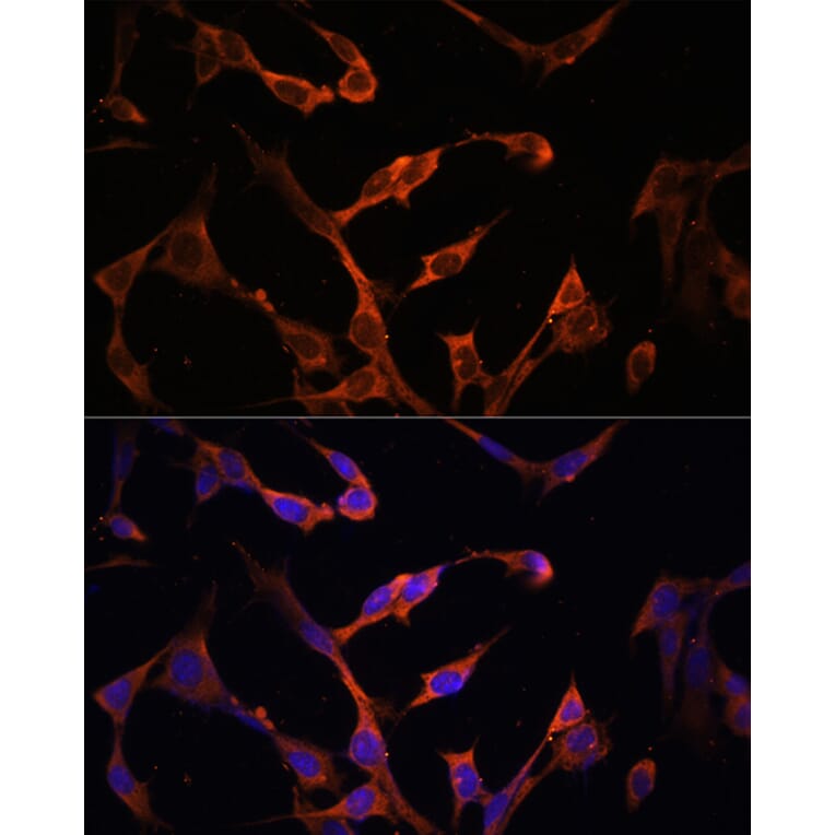 Immunofluorescence - Anti-MHC Class II beta Antibody (A306106) - Antibodies.com