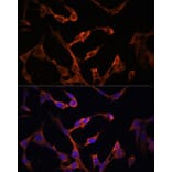 Immunofluorescence - Anti-MHC Class II beta Antibody (A306106) - Antibodies.com