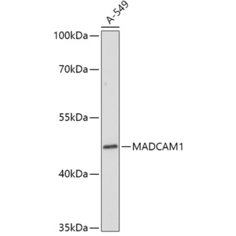 Western Blot - Anti-MAdCAM1 Antibody (A306107) - Antibodies.com