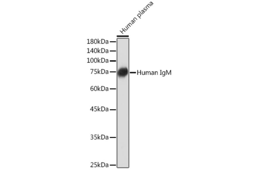 Western Blot - Anti-Human IgM Antibody [ARC2245] (A306108) - Antibodies.com
