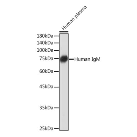 Western Blot - Anti-Human IgM Antibody [ARC2245] (A306108) - Antibodies.com