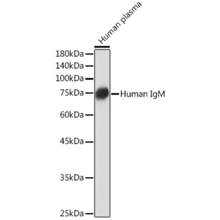 Western Blot - Anti-Human IgM Antibody [ARC2245] (A306108) - Antibodies.com