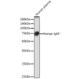 Western Blot - Anti-Human IgM Antibody [ARC2245] (A306108) - Antibodies.com