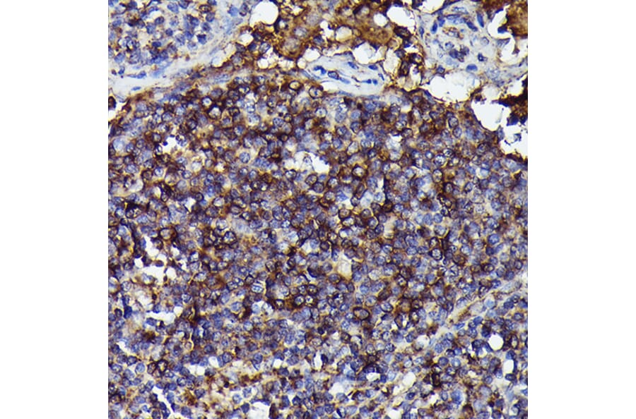Immunohistochemistry - Anti-Human IgM Antibody [ARC2245] (A306108) - Antibodies.com