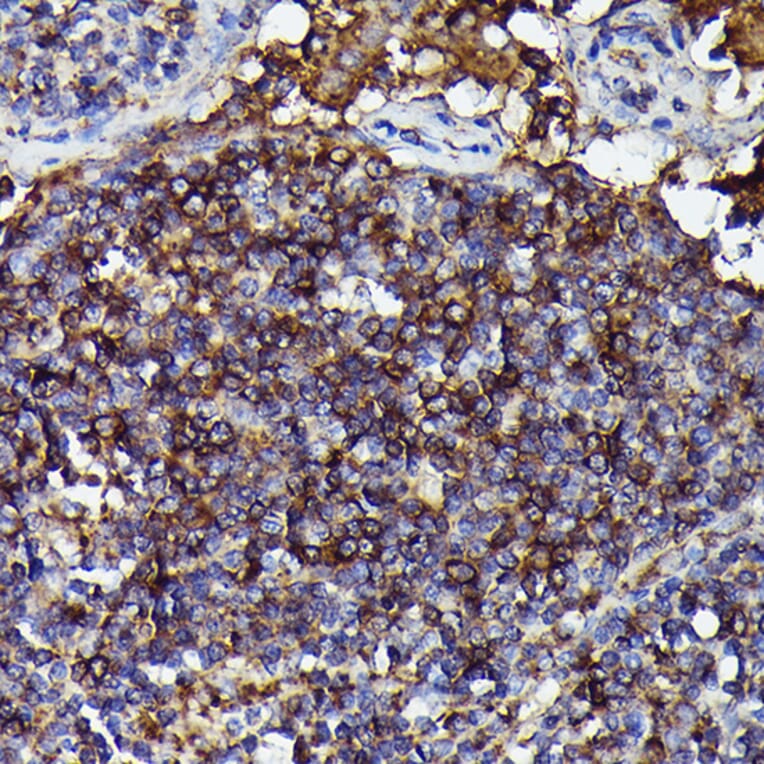 Immunohistochemistry - Anti-Human IgM Antibody [ARC2245] (A306108) - Antibodies.com