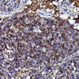 Immunohistochemistry - Anti-Human IgM Antibody [ARC2245] (A306108) - Antibodies.com