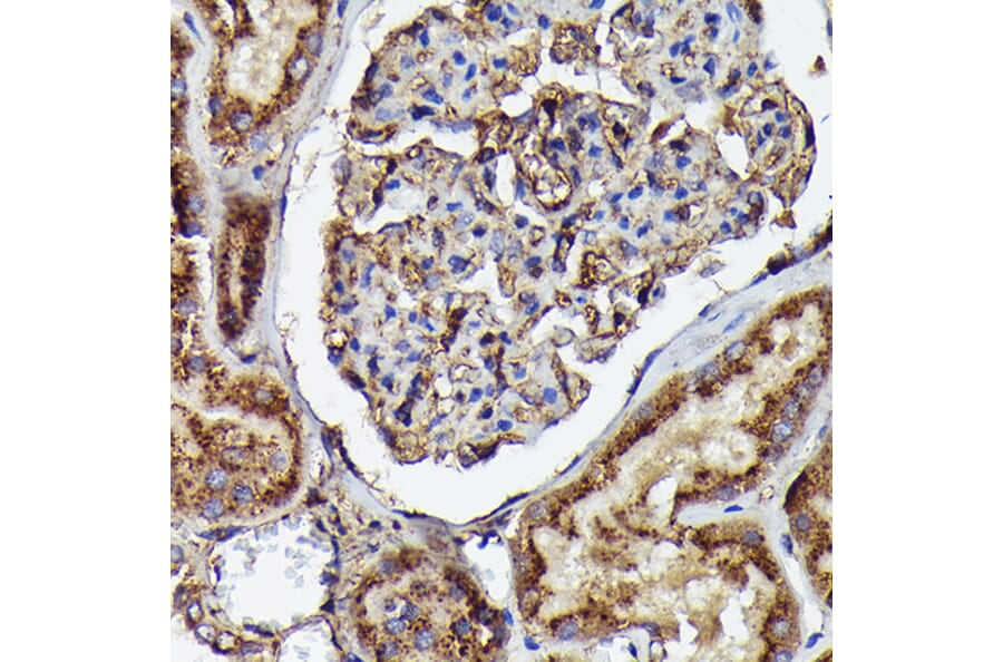 Immunohistochemistry - Anti-Human IgM Antibody [ARC2245] (A306108) - Antibodies.com
