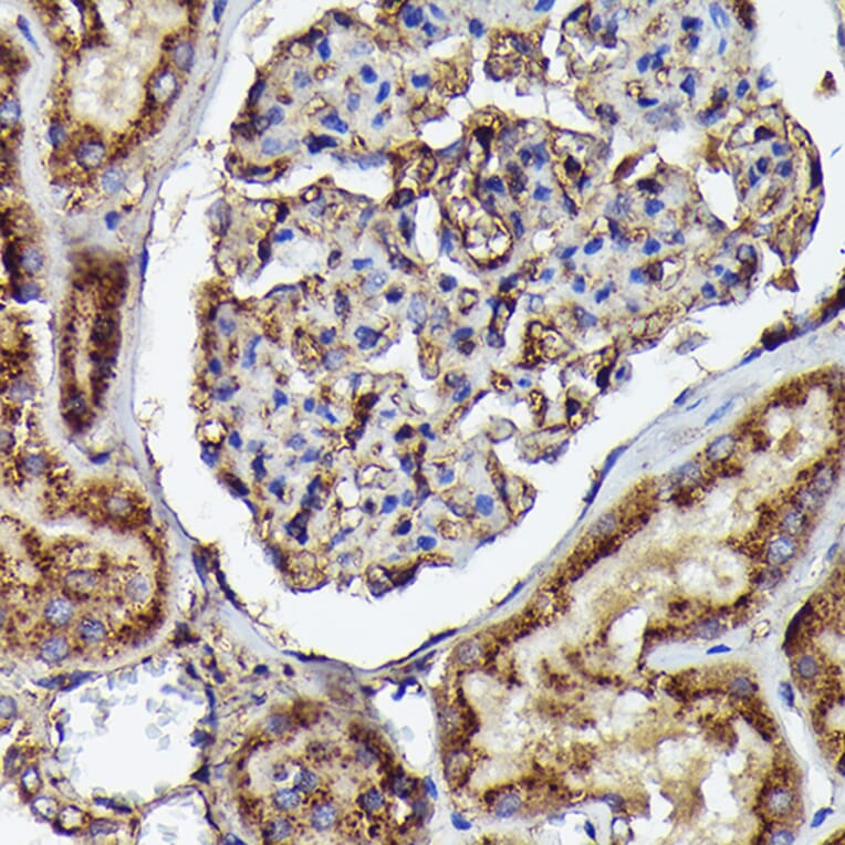 Immunohistochemistry - Anti-Human IgM Antibody [ARC2245] (A306108) - Antibodies.com