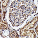Immunohistochemistry - Anti-Human IgM Antibody [ARC2245] (A306108) - Antibodies.com