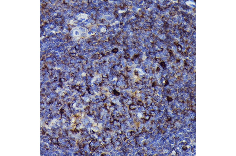 Immunohistochemistry - Anti-Human IgM Antibody [ARC2245] (A306108) - Antibodies.com