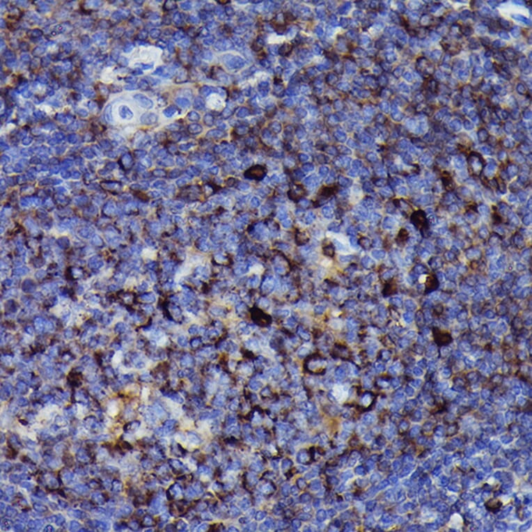 Immunohistochemistry - Anti-Human IgM Antibody [ARC2245] (A306108) - Antibodies.com