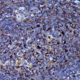 Immunohistochemistry - Anti-Human IgM Antibody [ARC2245] (A306108) - Antibodies.com