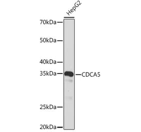 Western Blot - Anti-CDCA5 Antibody [ARC2096] (A306109) - Antibodies.com