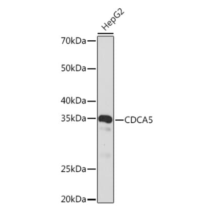 Western Blot - Anti-CDCA5 Antibody [ARC2096] (A306109) - Antibodies.com