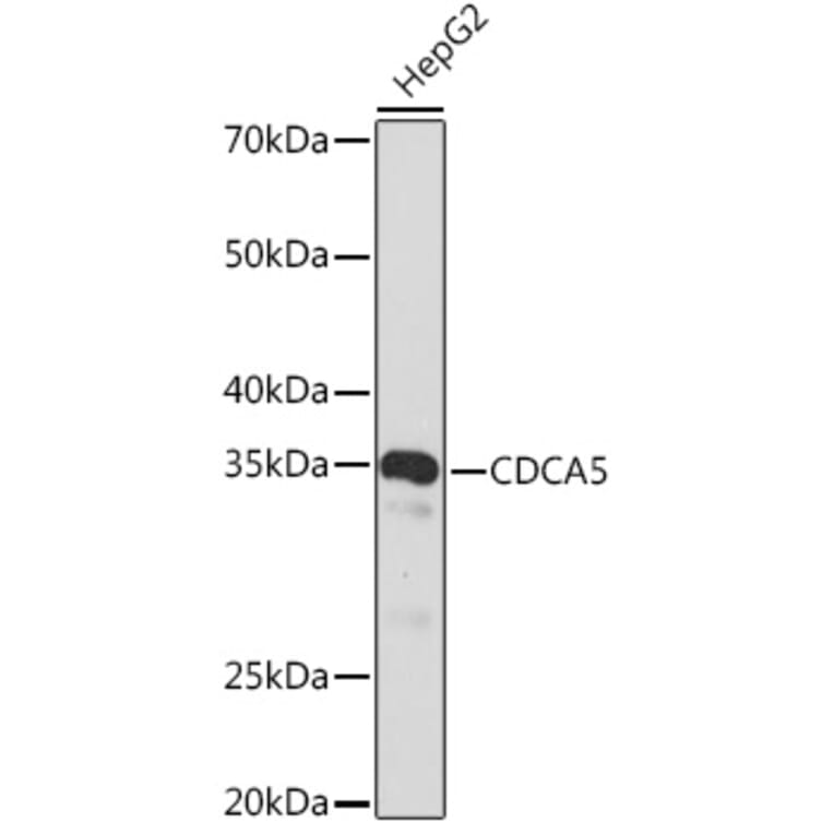 Western Blot - Anti-CDCA5 Antibody [ARC2096] (A306109) - Antibodies.com