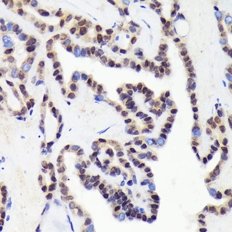 Immunohistochemistry - Anti-CDCA5 Antibody [ARC2096] (A306109) - Antibodies.com