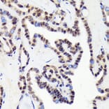 Immunohistochemistry - Anti-CDCA5 Antibody [ARC2096] (A306109) - Antibodies.com