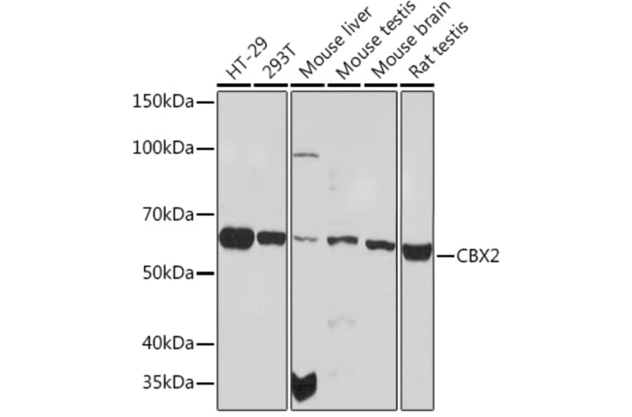 Western Blot - Anti-CBX2 Antibody [ARC1939] (A306110) - Antibodies.com