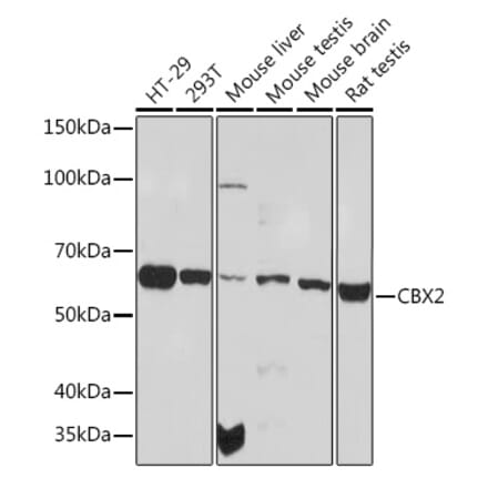 Western Blot - Anti-CBX2 Antibody [ARC1939] (A306110) - Antibodies.com