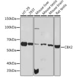 Western Blot - Anti-CBX2 Antibody [ARC1939] (A306110) - Antibodies.com