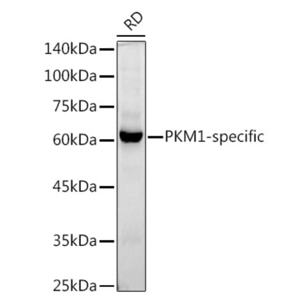 Western Blot - Anti-PKM Antibody [ARC50938] (A306112) - Antibodies.com