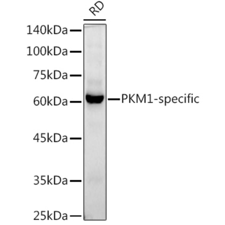 Western Blot - Anti-PKM Antibody [ARC50938] (A306112) - Antibodies.com