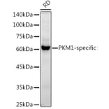 Western Blot - Anti-PKM Antibody [ARC50938] (A306112) - Antibodies.com