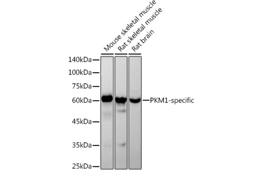 Western Blot - Anti-PKM Antibody [ARC50938] (A306112) - Antibodies.com