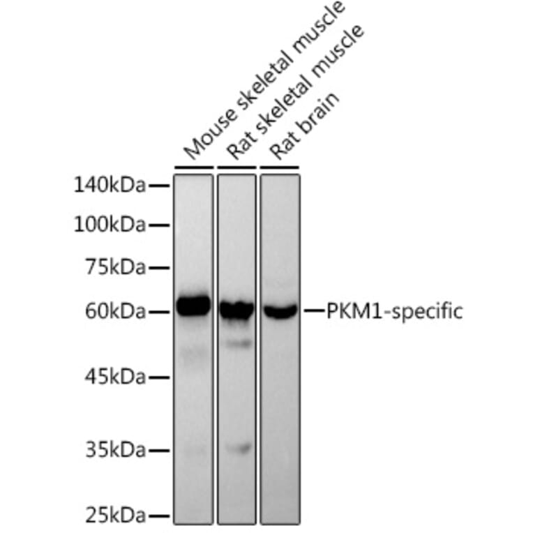 Western Blot - Anti-PKM Antibody [ARC50938] (A306112) - Antibodies.com