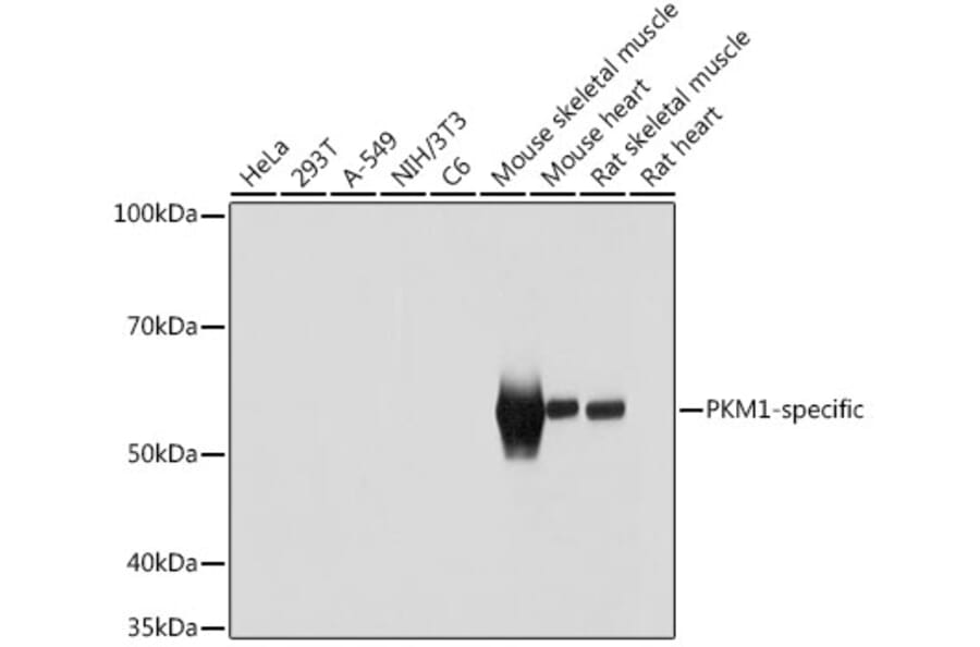 Western Blot - Anti-PKM Antibody (A306113) - Antibodies.com