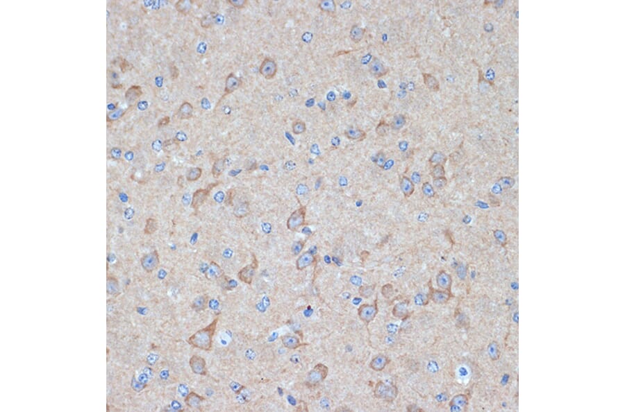 Immunohistochemistry - Anti-PKM Antibody (A306113) - Antibodies.com