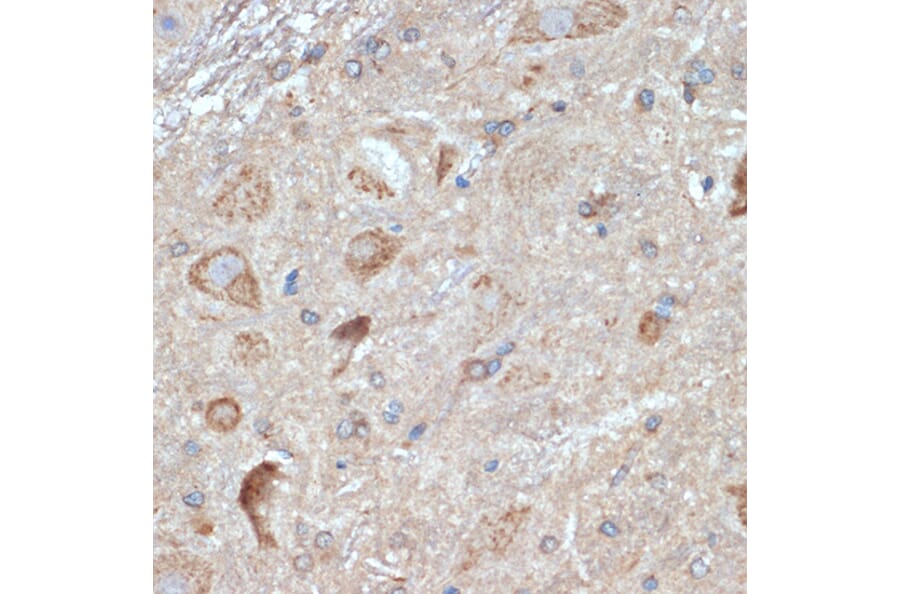 Immunohistochemistry - Anti-PKM Antibody (A306113) - Antibodies.com