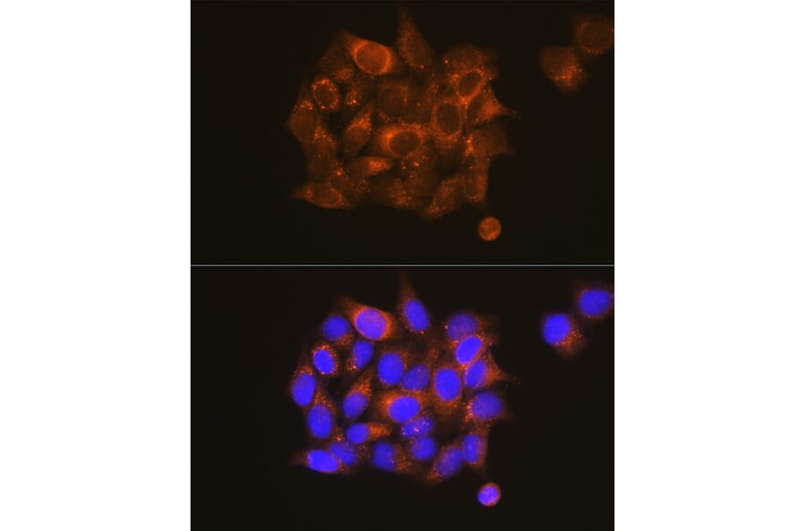 Immunofluorescence - Anti-PKM Antibody (A306113) - Antibodies.com