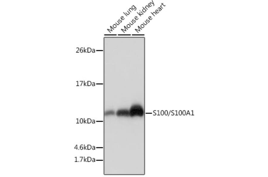 Western Blot - Anti-S100 alpha Antibody [ARC0404] (A306114) - Antibodies.com
