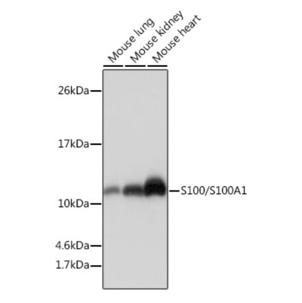 Western Blot - Anti-S100 alpha Antibody [ARC0404] (A306114) - Antibodies.com