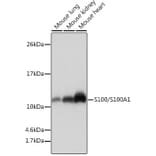 Western Blot - Anti-S100 alpha Antibody [ARC0404] (A306114) - Antibodies.com