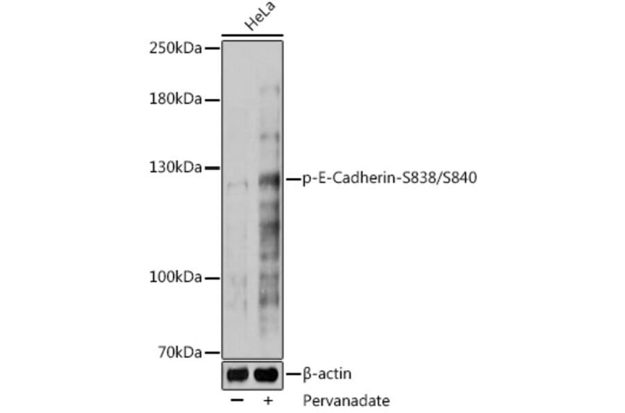 Western Blot - Anti-E Cadherin (phospho Ser838 + Ser840) Antibody (A306115) - Antibodies.com