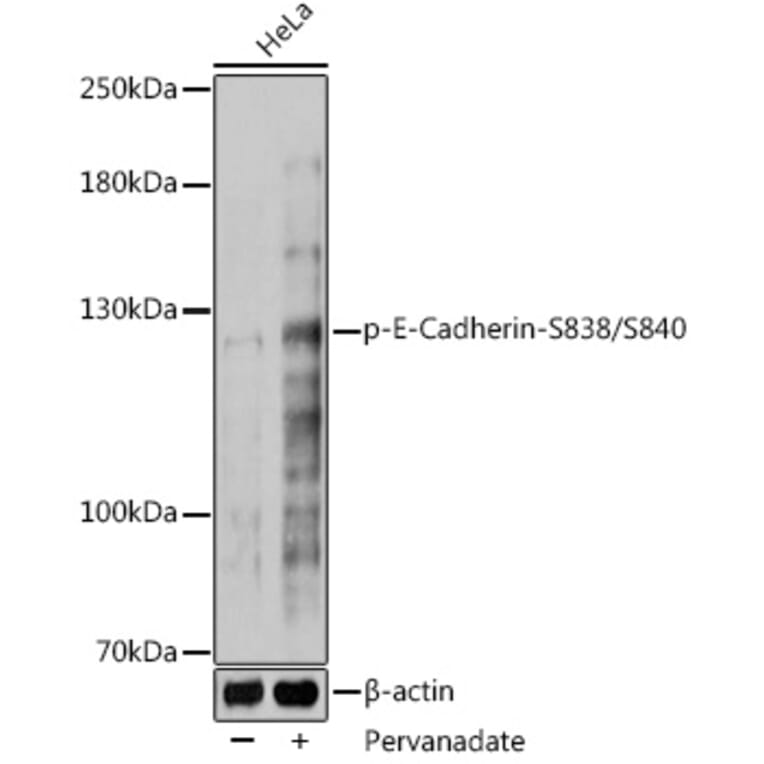 Western Blot - Anti-E Cadherin (phospho Ser838 + Ser840) Antibody (A306115) - Antibodies.com