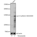 Western Blot - Anti-E Cadherin (phospho Ser838 + Ser840) Antibody (A306115) - Antibodies.com