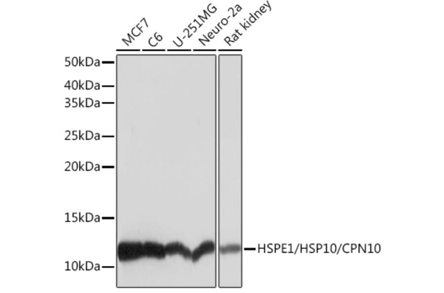Western Blot - Anti-EPF Antibody [ARC1411] (A306116) - Antibodies.com