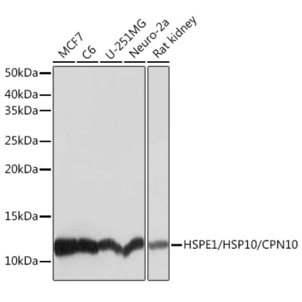 Western Blot - Anti-EPF Antibody [ARC1411] (A306116) - Antibodies.com