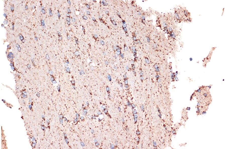 Immunohistochemistry - Anti-EPF Antibody [ARC1411] (A306116) - Antibodies.com