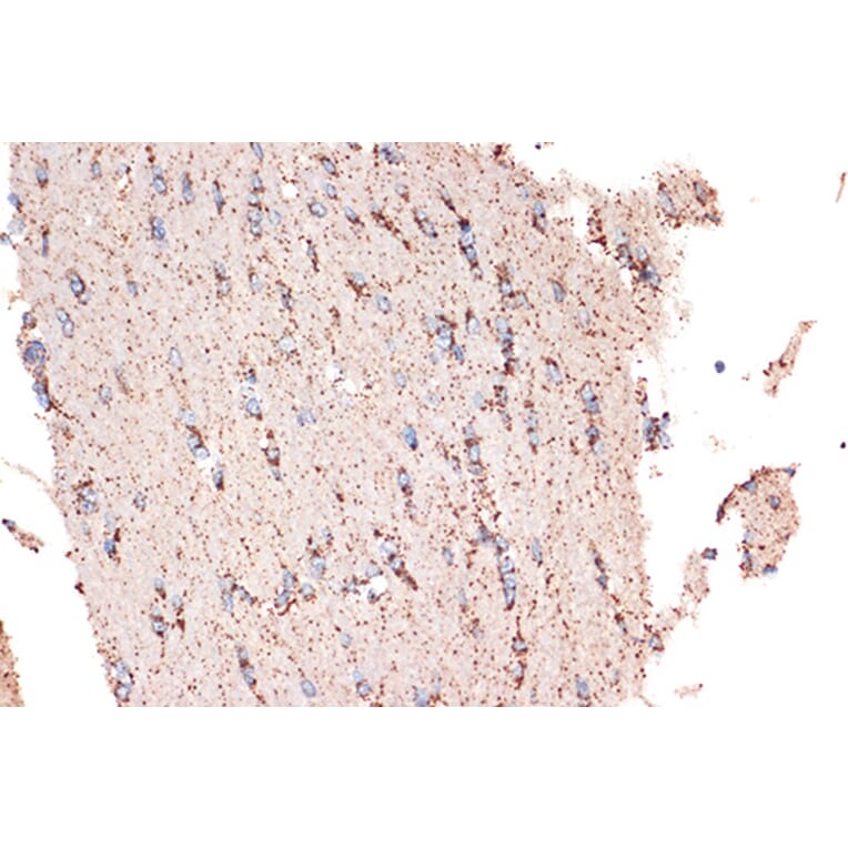Immunohistochemistry - Anti-EPF Antibody [ARC1411] (A306116) - Antibodies.com